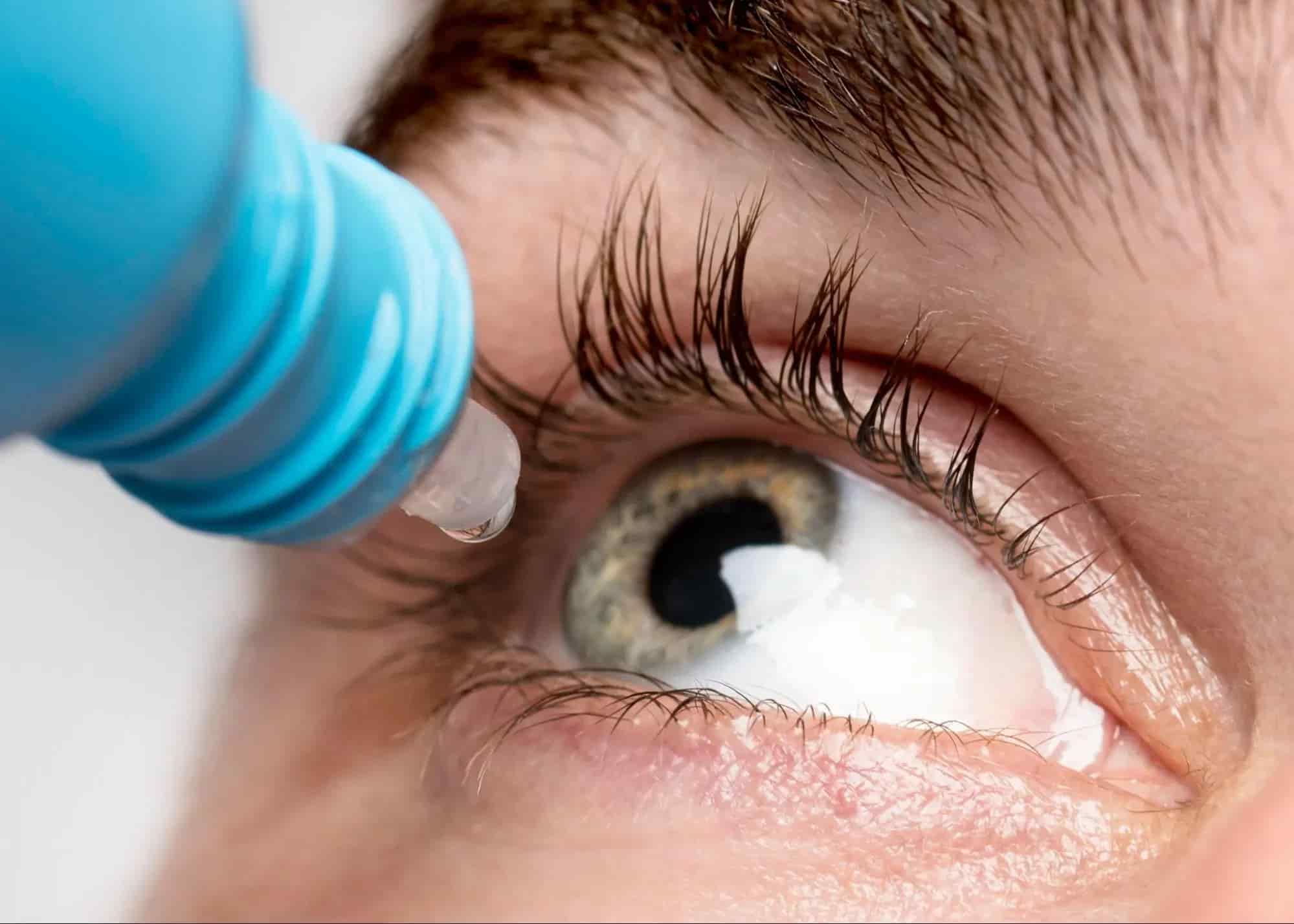 eye-drops