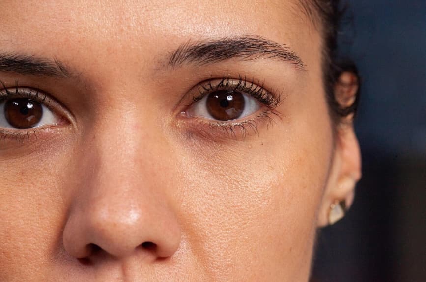 ตุ่มใสที่เปลือกตาเกิดจาก