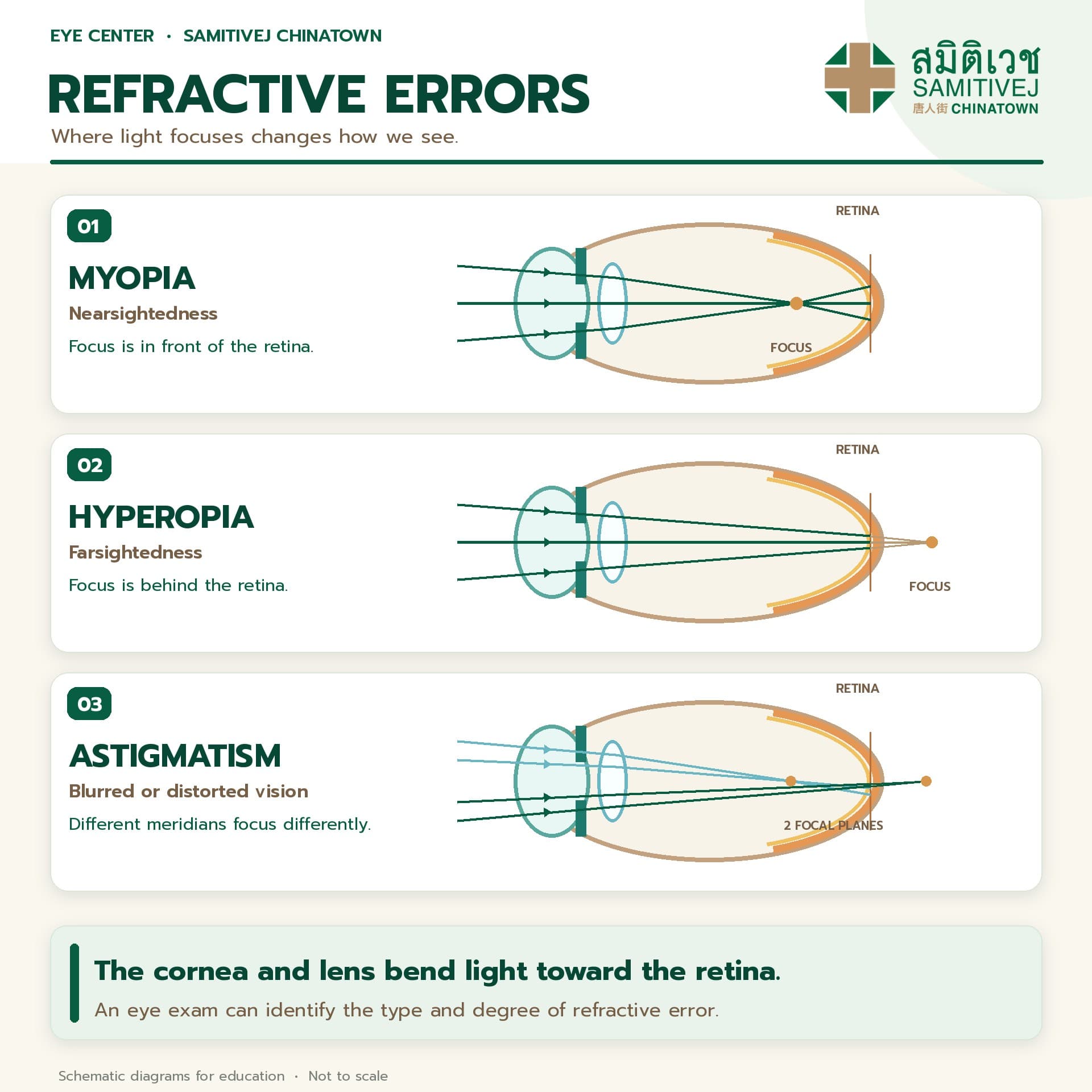 Refractive Errors