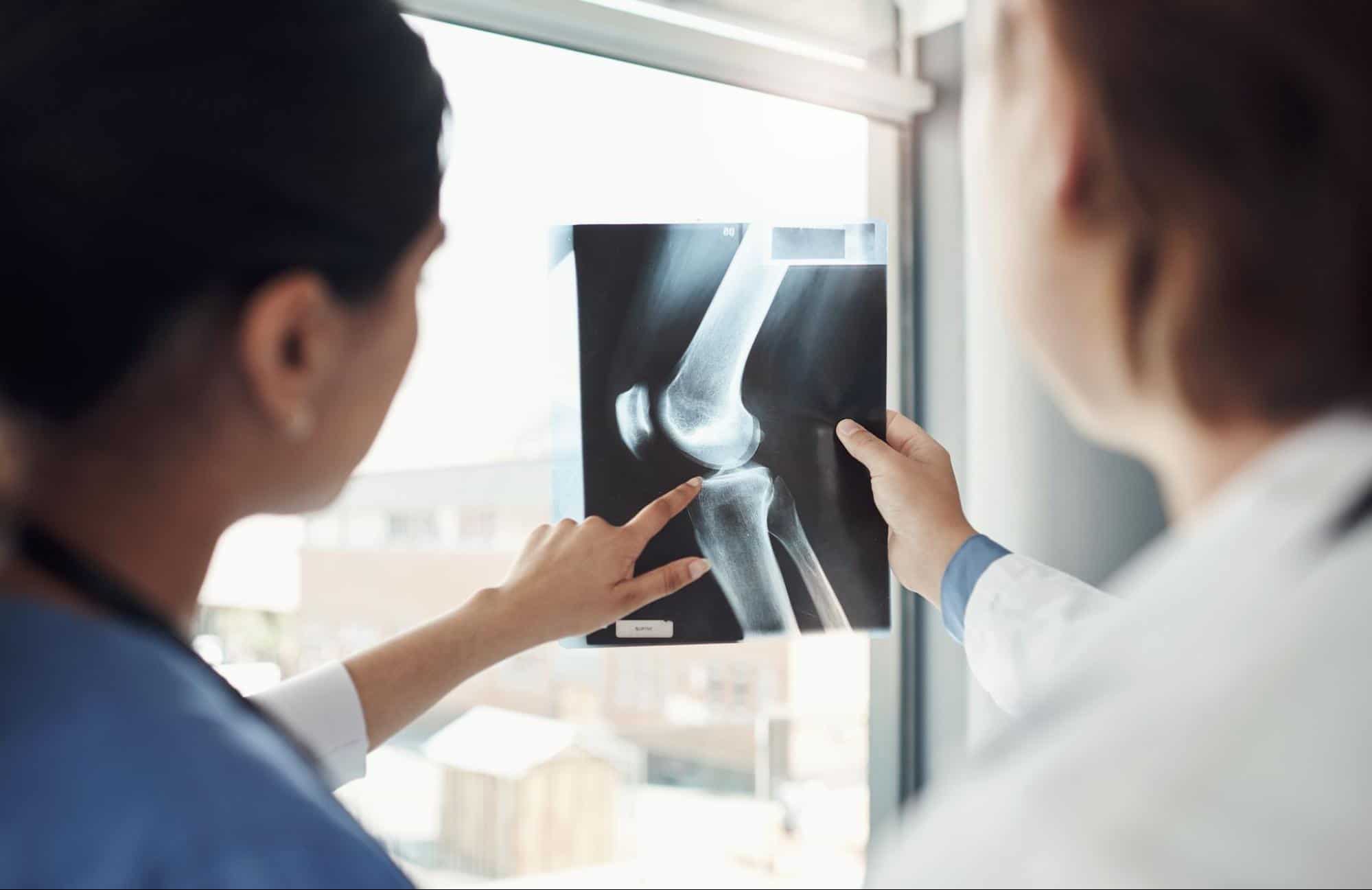 ข้อดีและข้อจำกัดของการทำ MRI เข่า