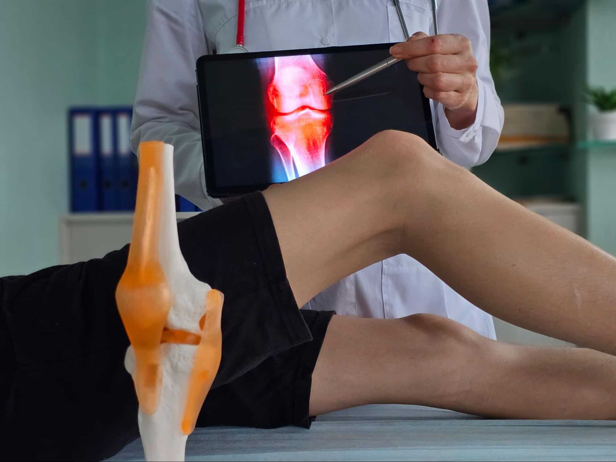 MRI เข่า