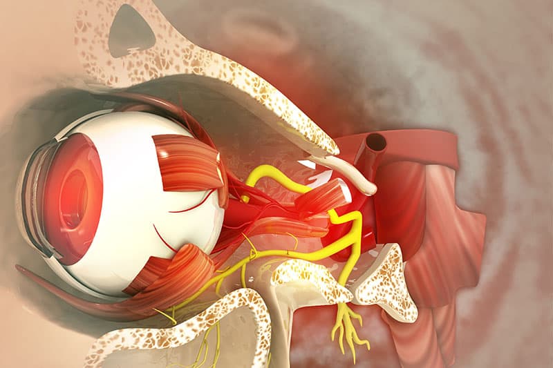 ต้อหิน ประเภท