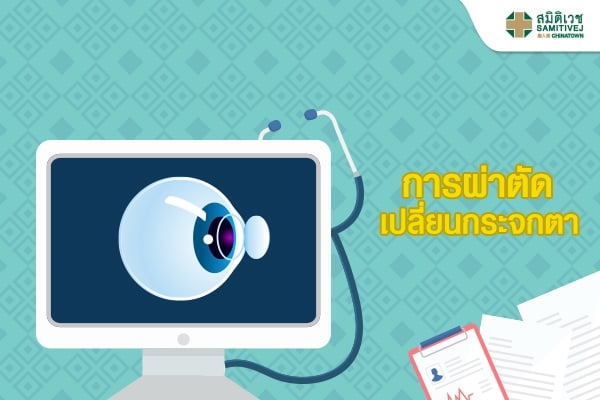 การผ่าตัดเปลี่ยนกระจกตา (Corneal Transplantation)