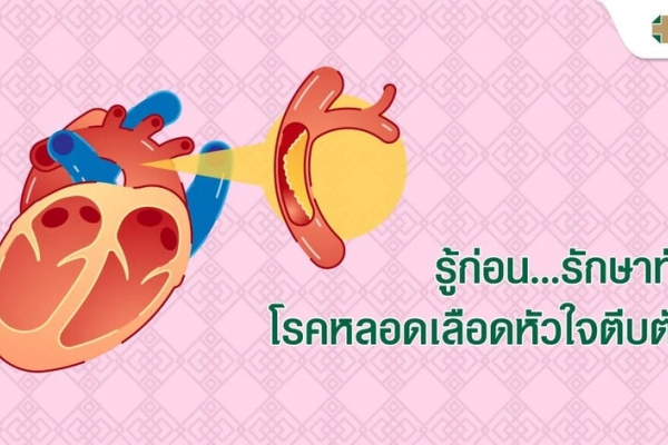 โรคหลอดเลือดหัวใจตีบ เส้นเลือดหัวใจตีบ รู้ตัวก่อน รักษาหายไวกว่า