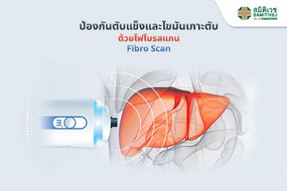 ป้องกันตับแข็งและไขมันเกาะตับด้วยไฟโบรสแกน (Fibro Scan)