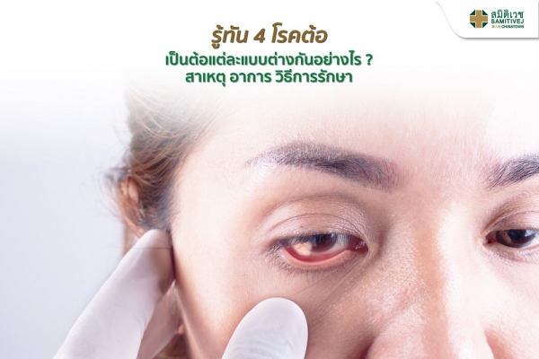 รู้ทัน 4 โรคต้อ เป็นต้อแต่ละแบบต่างกันอย่างไร สาเหตุ อาการ วิธีการรักษา