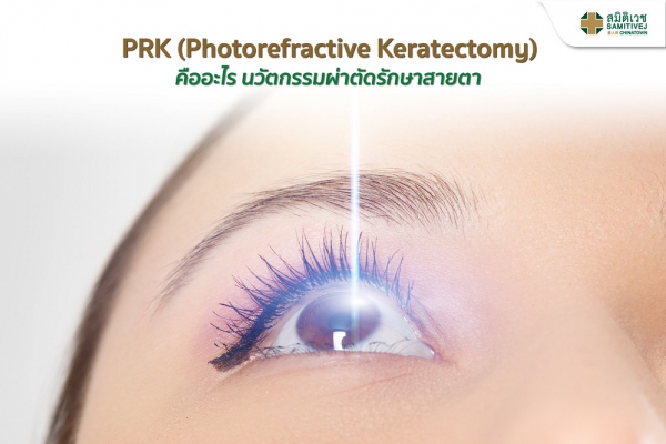 PRK (Photorefractive Keratectomy) คืออะไร นวัตกรรมผ่าตัดรักษาสายตา