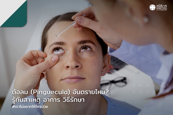 รู้ทันต้อลม (Pinguecula) อาการ สาเหตุ พร้อมแนะนำวิธีรักษาต้อลม