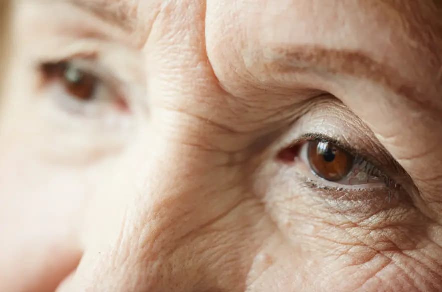 Understanding Cataract’s Causes, Symptoms, Treatment and Prevention